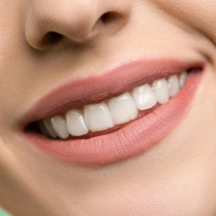 Estética dental