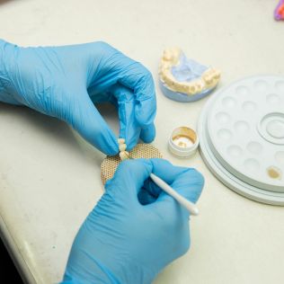 Prótesis dental