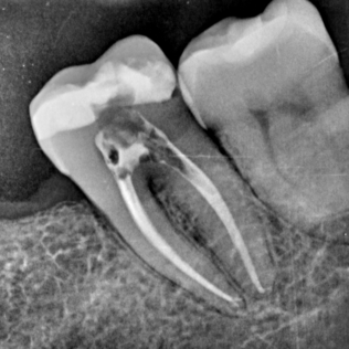 Servicio Endodoncia