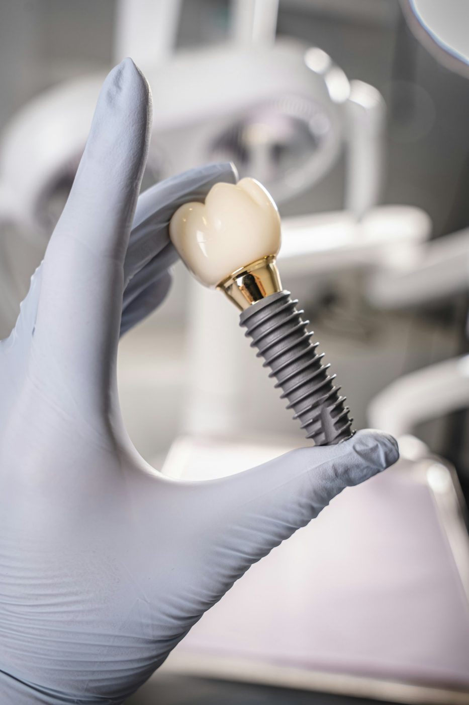 Implante dental con corona sostenido con guante en la clínica