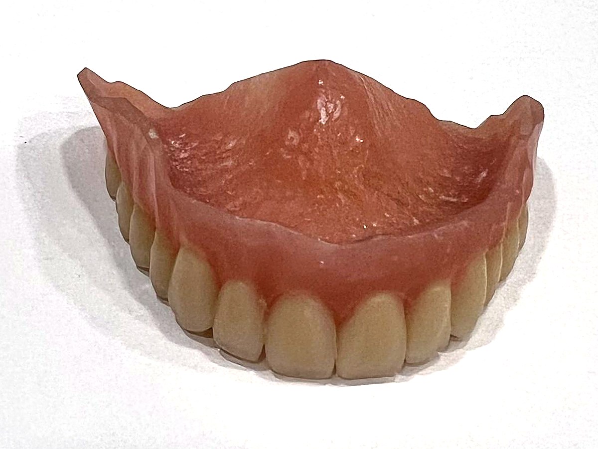 Prótesis dental completa superior de resina