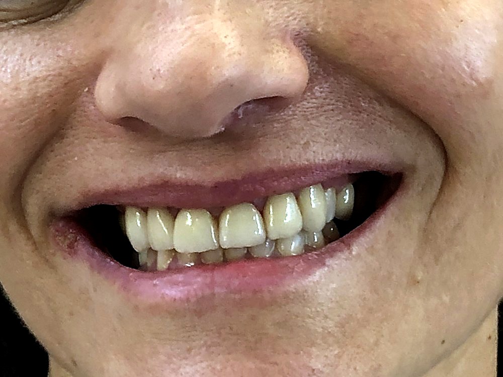 Sonrisa después del tratamiento estético